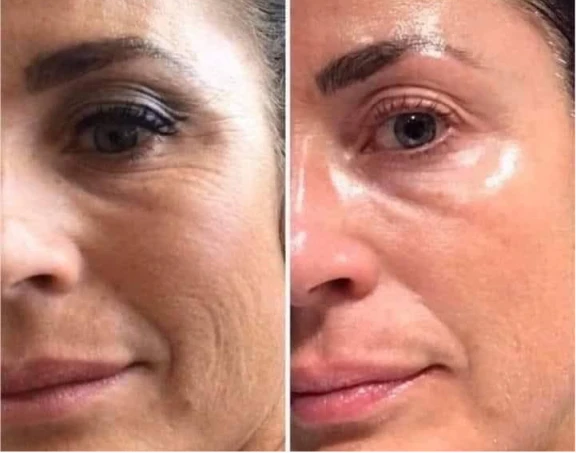 Antes e depois de Mirella S.