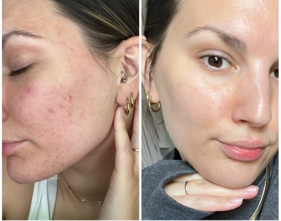 Antes e depois de Daniela P.
