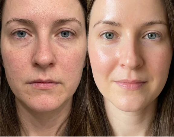 Antes e depois de Juliana M.